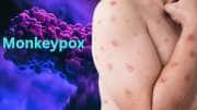 Monkeypox Virus: குரங்கு அம்மை அறிகுறிகளுடன் எய்ம்ஸ் வந்த நோயாளி... மருத்துவமனையில் பரபரப்பு