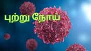 எச்சரிக்கை.... இந்த உணவுகள் புற்றுநோயை வரவழைக்கும் ஆபத்தை கொண்டவை