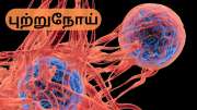 Preventing Cancer: புற்றுநோய் வராமல் இருக்க தினமும் நடங்க... டாக்டர் கூறும் அட்வைஸ்