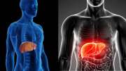 Fatty Liver : கொழுப்பு கல்லீரல் முதல் நிலை ஆபத்தானதா? அவசியம் தெரிந்து கொள்ளுங்கள்