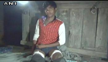 சீருடை அணியாததால் காலை இழந்த மாணவன்!