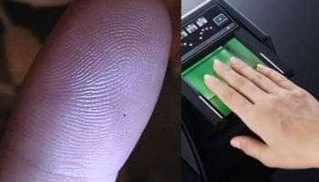 Fingerprints: தீக் காயங்களால் ‘கை விரல் ரேகைகள்’ மாறுமா; உண்மை என்ன!