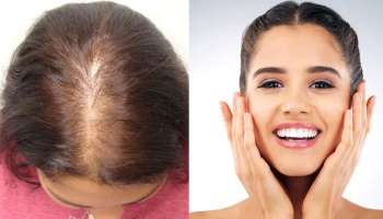 Hair Fall Problem: அடர்த்தியான முடி, பொலிவான சருமம் பெற இத சாப்பிடுங்க