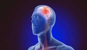 பக்கவாதத்தை முன்கூட்டியே உணர்த்தக்கூடிய முக்கியமான அறிகுறிகள்!