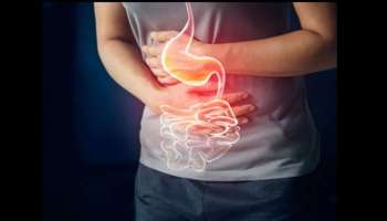 அசிடிட்டி பிரச்சனை பாடாய் படுத்துகிறதா.. எளிய தீர்வுகள் இதோ!