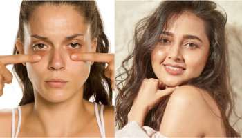 கண்ணின் ‘கருவளையங்களை’ விரட்டும் சில அற்புத எண்ணெய்கள்!