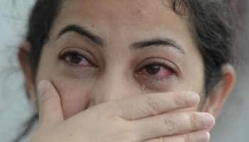 எச்சரிக்கை! கண்களில் இந்த அறிகுறிகள் இருந்தால் புறக்கணிக்க வேண்டாம்!