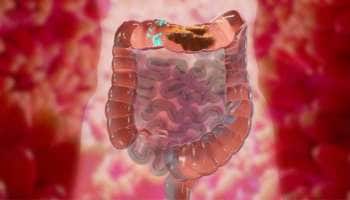 அசுத்தமான குடலை சுத்தம் செய்யும் அற்புதமான 3 ஜூஸ்கள்