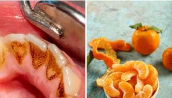 மஞ்சள் மஞ்சளா அசிங்கமா பற்கள் இருக்கா.. அப்போ 5 வீட்டு வைத்தியம் ட்ரை பண்ணுங்க