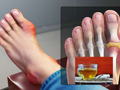 High Uric Acid பாடாய் படுத்துகிறதா? அப்போ சீரகத் தண்ணீரைக் குடியுங்கள்