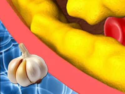 உடல் நரம்பில் இருந்து கொழுப்பை பிழிந்துவிடலாம், ஆனால் அதற்கு இதை சாப்பிடணும்