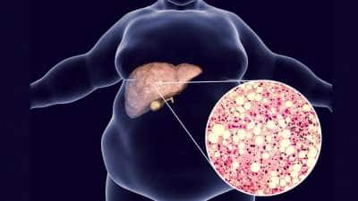 Liver Health: கல்லீரலை காலி செய்யும்... சில ஆபத்தான காலை பழக்கங்கள்