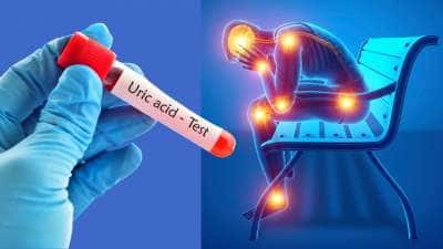 Uric Acid: எகிறும் யூரிக் அமிலத்தை விரட்டி அடிக்கும் சில மேஜிக்  இலைகள்