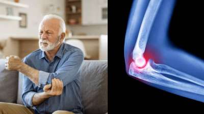 Bone health | எலும்பு, மூட்டு வலி அவதிப்படுத்துகிறதா? ஸ்பெஷலான 5 உணவுகளை சாப்பிடுங்க