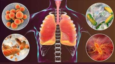 Lungs Detox: நுரையீரலில் சேரும் நச்சுக்களை நீக்க உதவும்... உணவுகளும் பழக்கங்களும்