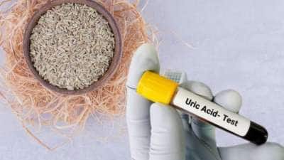 யூரிக் அமில அளவை கட்டுப்படுத்த உதவும் ஓமம்: இப்படி உட்கொண்டால் அதிக பயன்