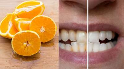 ஆரஞ்சு பழ தோலை வைத்து பற்களில் இருக்கும் மஞ்சள் கறையை போக்க டிப்ஸ்..!
