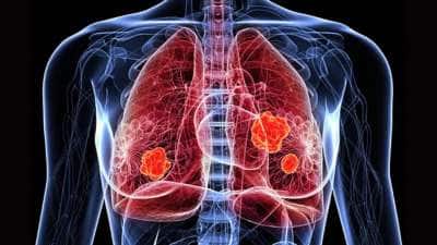 Lungs Detox: நுரையீரலை இயற்கையாக டீடாக்ஸ் செய்ய உதவும் சில உணவுகளும்... பழக்கங்களும்