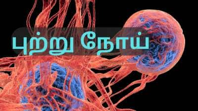 நமது வாழ்க்கை முறையே புற்றுநோய்க்கு முக்கிய காரணம்... எச்சரிக்கும் மருத்துவர்கள்