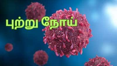 எச்சரிக்கை.... இந்த உணவுகள் புற்றுநோயை வரவழைக்கும் ஆபத்தை கொண்டவை