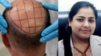 2 உயிரை பறித்த முடி மாற்று அறுவை சிகிச்சை! என்ன நடந்தது? முழு விவரம்!