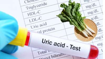 யூரிக் அமிலத்திற்கு மருந்தாகும் முள்ளங்கி இலைகள்... பயன்படுத்தும் முறை இது தான்