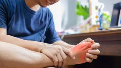 யூரிக் அமிலத்தின் 7 லேசான அறிகுறிகள்! ஆரம்பத்திலேயே கண்டுகொள்ளுங்கள்..