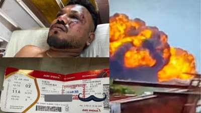 அகமதாபாத் விமான விபத்து : ஒருவர் உயிருடன் இருக்கிறார், புகைப்படத்தை வெளியிட்ட காவல்துறை