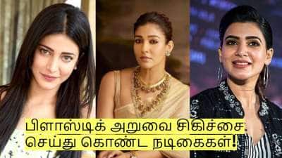 பிளாஸ்டிக் அறுவை சிகிச்சை செய்து கொண்ட நடிகைகள் யார் யார் தெரியுமா? 
