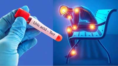 மூட்டு வலி, யூரிக் அமில பிரச்சனைக்கு...  தீர்வைத் தரும் சூப்பர் உணவுகள்