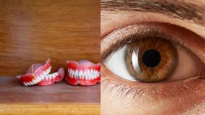 கண்களில் வளர்ந்த பல்! மருத்துவ உலகில் வினோதம்..கடைசியில் என்ன ஆச்சு?