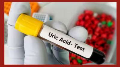 யூரிக் அமில அளவு அதிகரிக்க முக்கிய காரணம் என்ன? லிஸ்ட் இதோ... நோட் பண்ணுங்க மக்களே