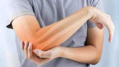 யூரிக் அமில பிரச்சனை உள்ளதா? இந்த சுவையான சட்னி சூப்பரான தீர்வா இருக்கும்