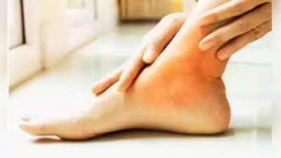 உடலில் யூரிக் அமிலம் அதிகரிக்க முக்கிய காரணம் என்ன?