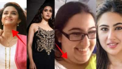 Face Fat : முகத்தின் அழகை கெடுக்கும் கொழுப்பு! குறைப்பது எப்படி? மருத்துவர் டிப்ஸ்..