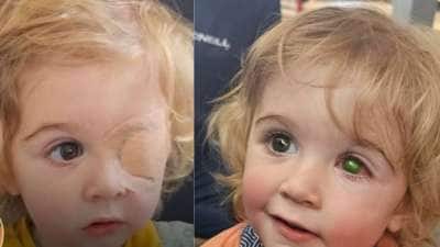 முத்தம் கொடுத்தால் பார்வை பறிபாேகுமா? குழந்தைக்கு வந்த நிலை..தாய் அதிர்ச்சி தகவல்