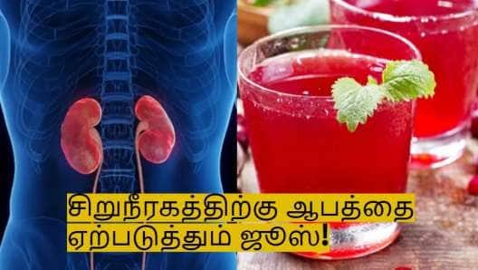 இந்த பானங்களை குடிப்பதை உடனே நிறுத்துங்கள்! சிறுநீரகங்களை சேதப்படுத்தும்! 