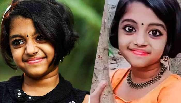  9 வயது TikTok பிரபலம் ஆருணி குருப் மூளை காய்சலால் மரணம்!!