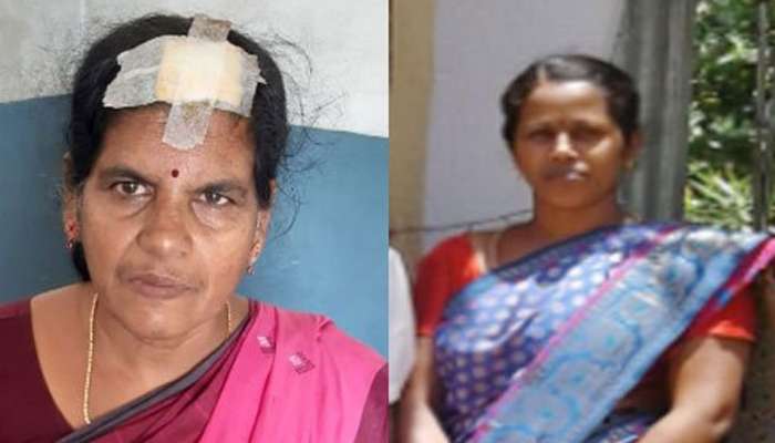 மருமகளின் வெறிச்செயலால் மாமியார் தலையில் 6 தையல் மருமகளின் வெறிச்செயலால் மாமியார் தலையில் 6 தையல்
