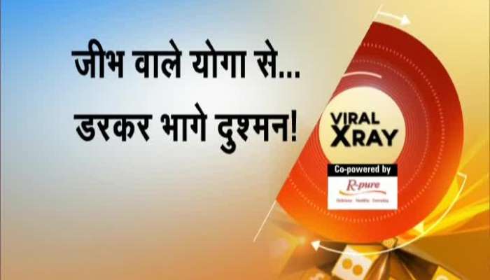 The Top viral video collection in Zee hindustans viral x-ray