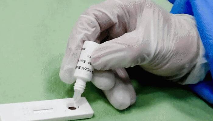 2500 ரூபாயில் கொரோனா வைரஸ் சோதனை செய்யப்படும்.. விலையை நிர்ணயித்த உ.பி அரசு 2500 ரூபாயில் கொரோனா வைரஸ் சோதனை செய்யப்படும்.. விலையை நிர்ணயித்த உ.பி அரசு