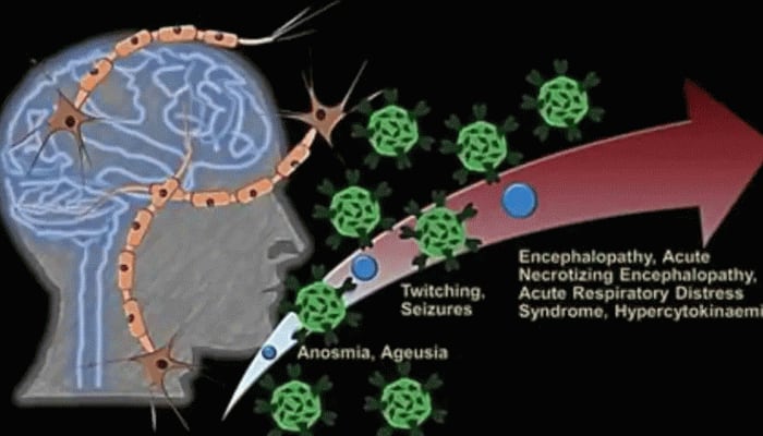 கொரோனா  மூளையையும் பாதிக்குமா? ஆய்வுகள் தரும் அதிர்ச்சியூட்டும் தகவல்கள்