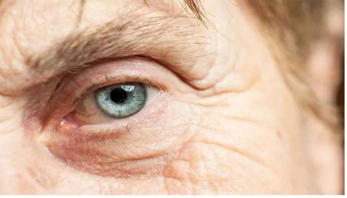 Cataract surgery: கண் அறுவை சிகிச்சைக்கு அரசு அனுமதி...!!! title=