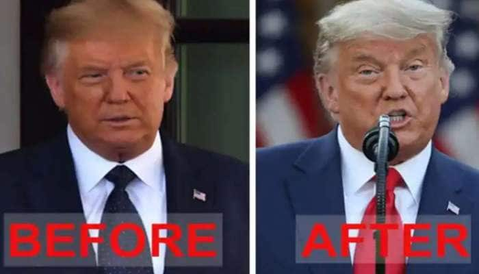 Hair Dye Colour தான் தேர்தல் முடிவுக்கு காரணமா Trump அவர்களே?