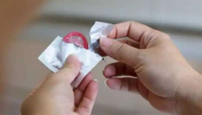 Condom Stuck in Woman Lungs: பெண்ணின் நுரையீரலில் ஆணுறை, மருத்துவர்கள் அதிர்ச்சி!