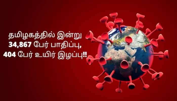 தமிழகத்தில் இன்று 34,867 பேருக்கு கொரோனா பாதிப்பு: 404 பேர் உயிர் இழப்பு!!  title=