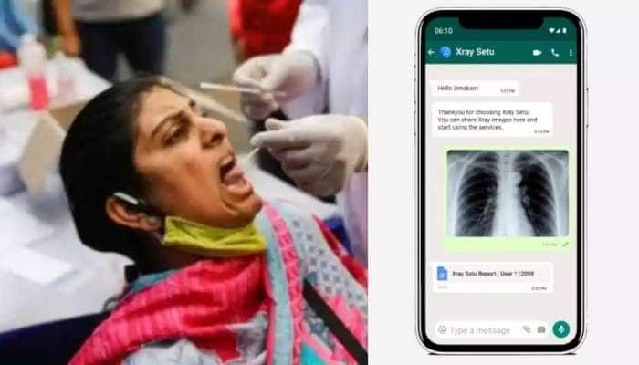 X-Ray Setu on Whatsapp: RT-PCR வசதியற்ற இடங்களுக்கு வரமாய் வந்த கோவிட் சோதனை முறை