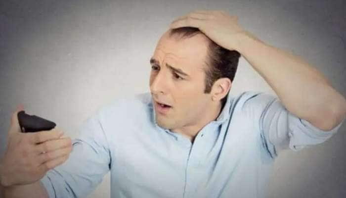 Hair Fall Treatment: வழுக்கை தலையாவதை தடுக்க இத ஃபாலோ பண்ணுங்க