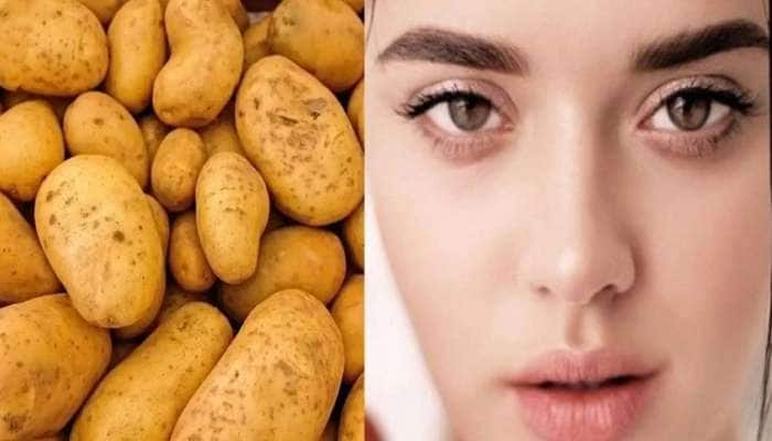 Beauty Tips: முகப்பொலிவு பெற மிக எளிய வழி உருளைக்கிழங்கில் இருக்கு!! 