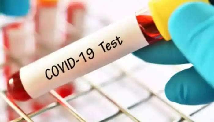 Coronavirus updates: தொடர்ந்து குறைந்துவரும் கோவிட் மரணங்கள்  